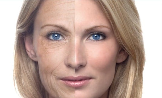 How To Remove Dark Circles Under Your Eyes Without Makeup