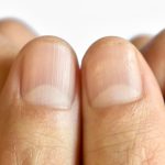 Understanding the Causes Behind Nail Ridges: What They Indicate About Your Health