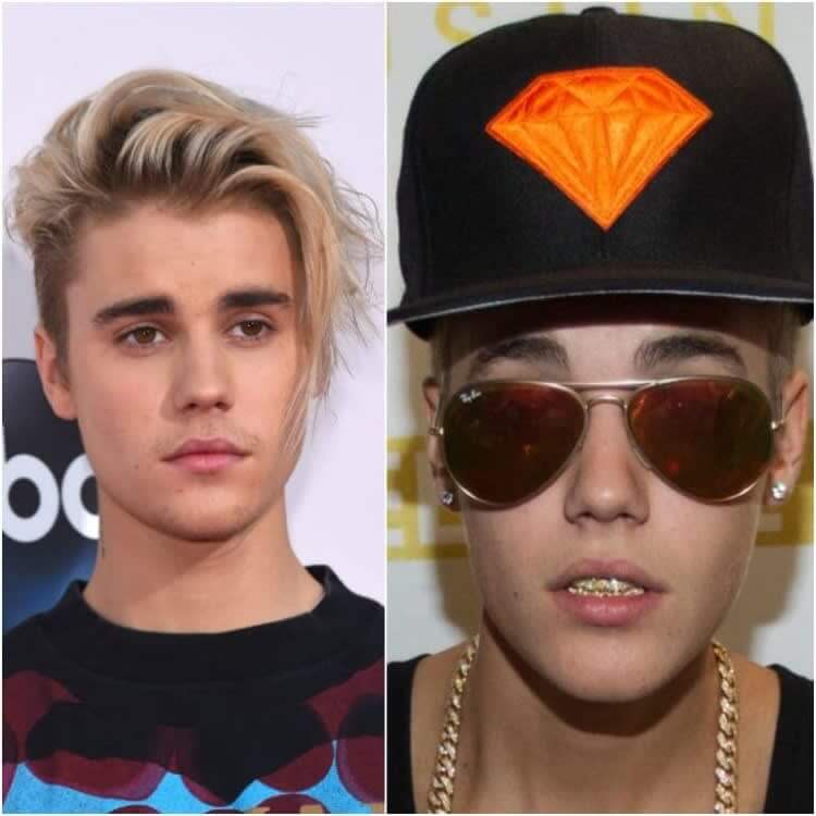 Justin Bieber's Blingy $5,000 Gold Grill: A Posh Halloween Statement
