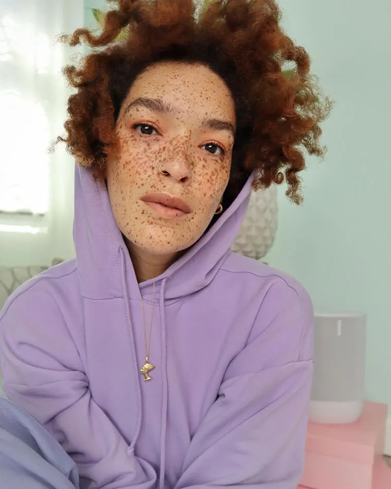Nikia Phoenix Tried Covering Up Her Freckles Before Embracing Them