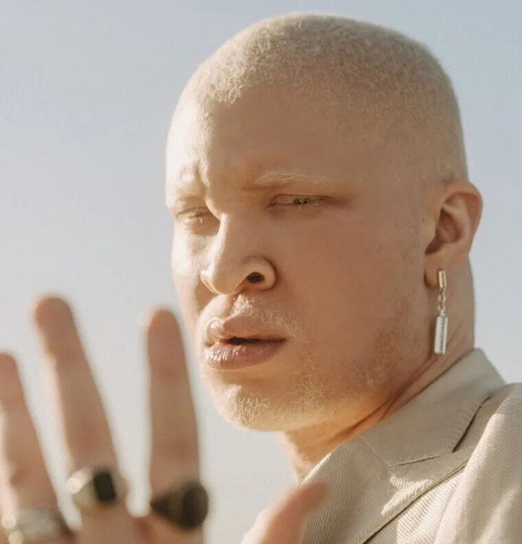 Shaun Ross's Albinism Turned the World of Fashion on Its Head